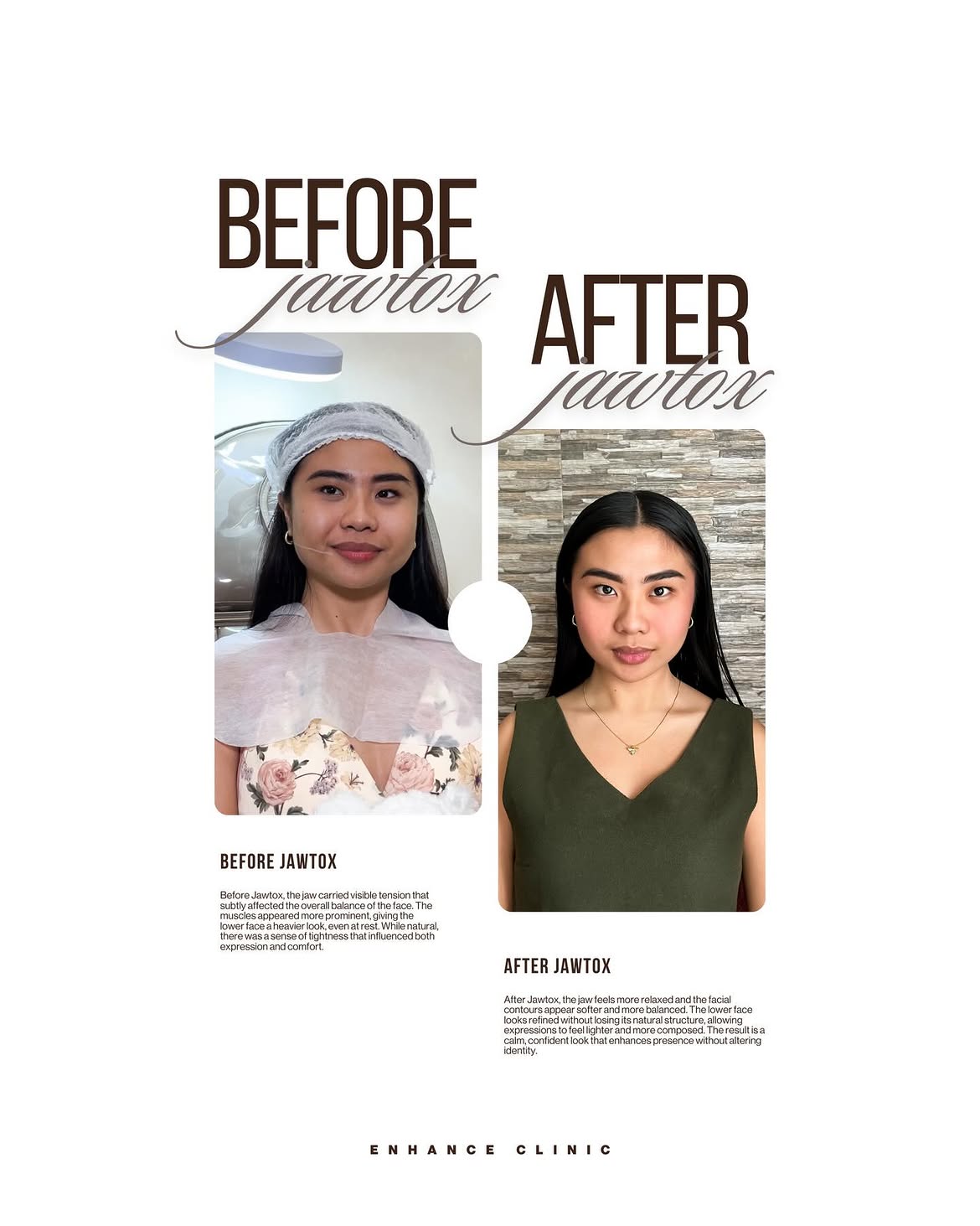 Before & After 5